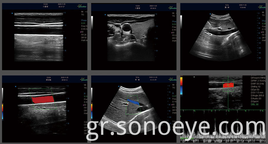 mini ultrasound